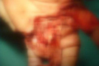 Hrvatska - sustav koji ne zna zabraniti petarde, prevenirati ozlijede niti napisati kazne?